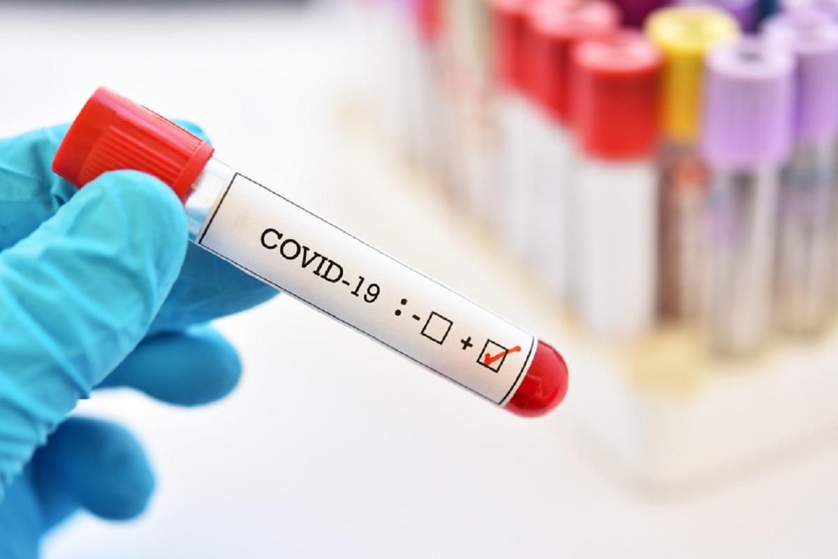 Чоловік підробив тест на коронавірус, що не розважатися з друзями