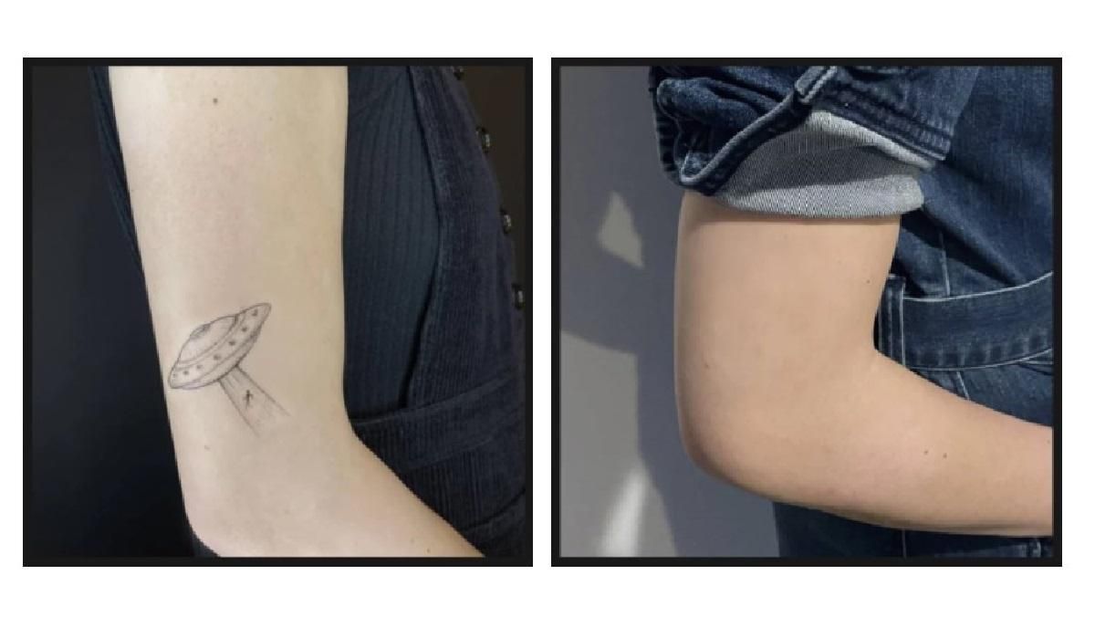 Революционные чернила: придумали временные татуировки, которые держатся на теле всего год