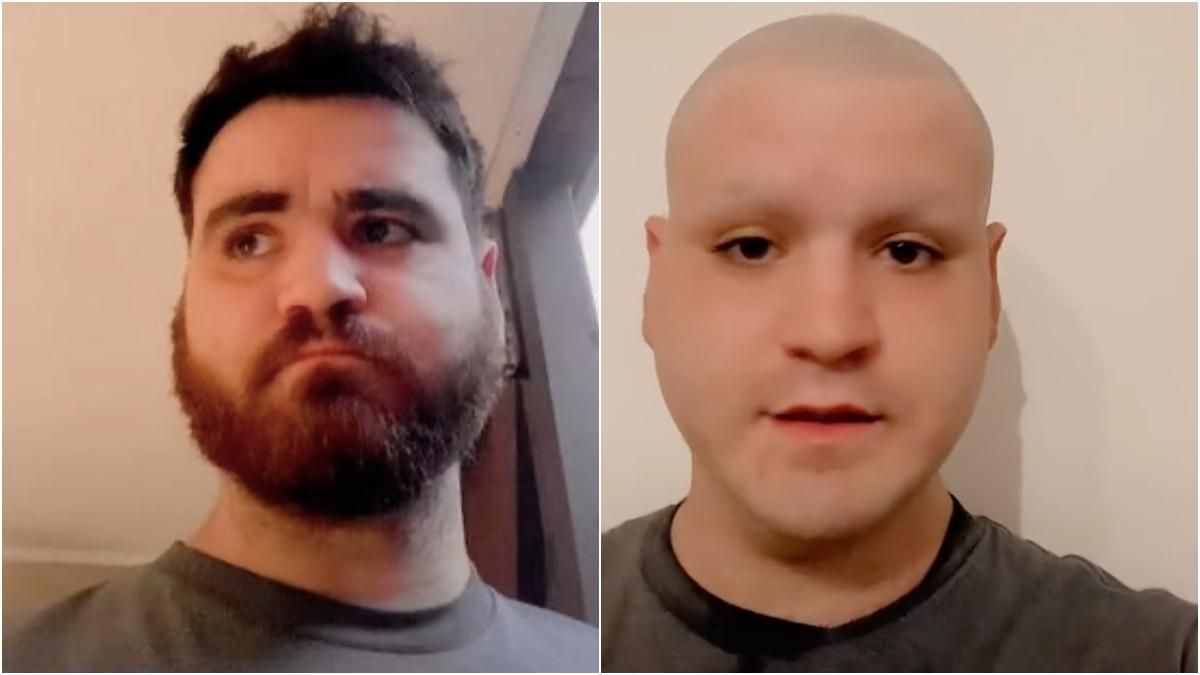 Болельщик побрился после поражения Англии на Евро-2020 Болельщик побрился после поражения Англии на Евро-2020