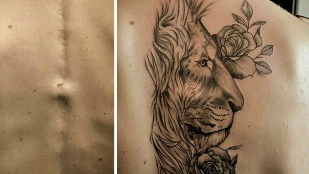 Никто не узнает: 15 раз, когда мастера превратили шрамы в невероятные татуировки - Развлечения
