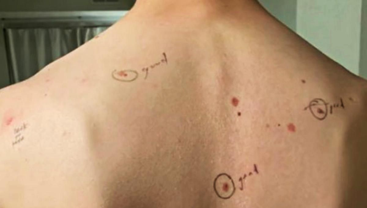 Дерматологиня залишила жінці послання на тілі її чоловіка: кумедне відео - Розваги Дерматологиня залишила жінці послання на тілі її чоловіка: кумедне відео - Розваги