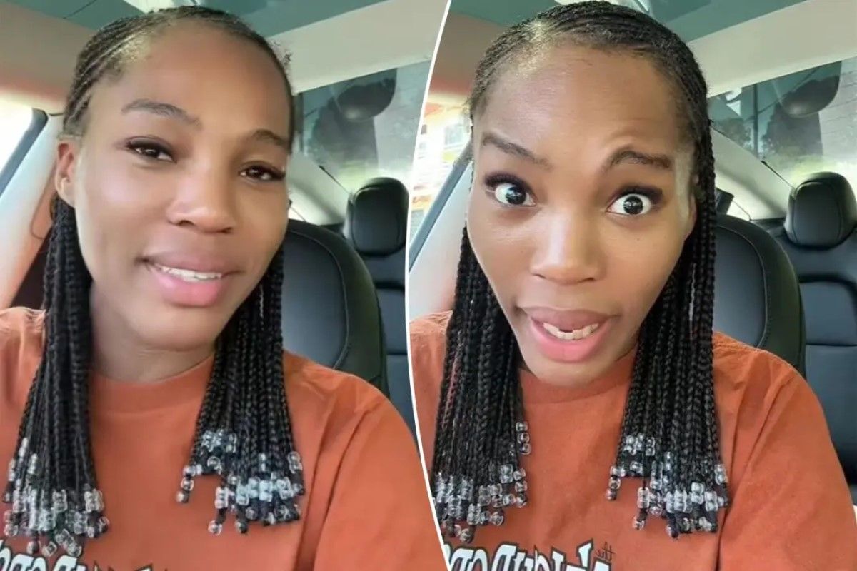 Дівчина запевняє, що їй невдало вкололи ботокс Дівчина запевняє, що їй невдало вкололи ботокс