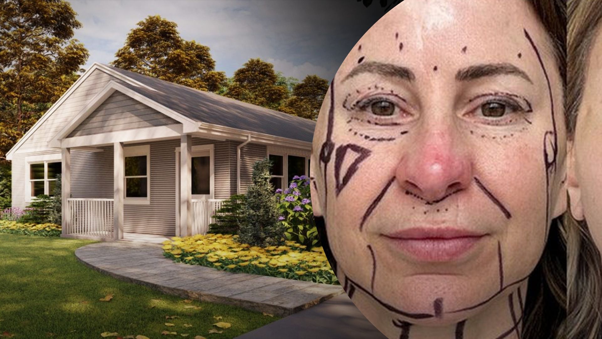 В США женщина продала дом ради пластической операции