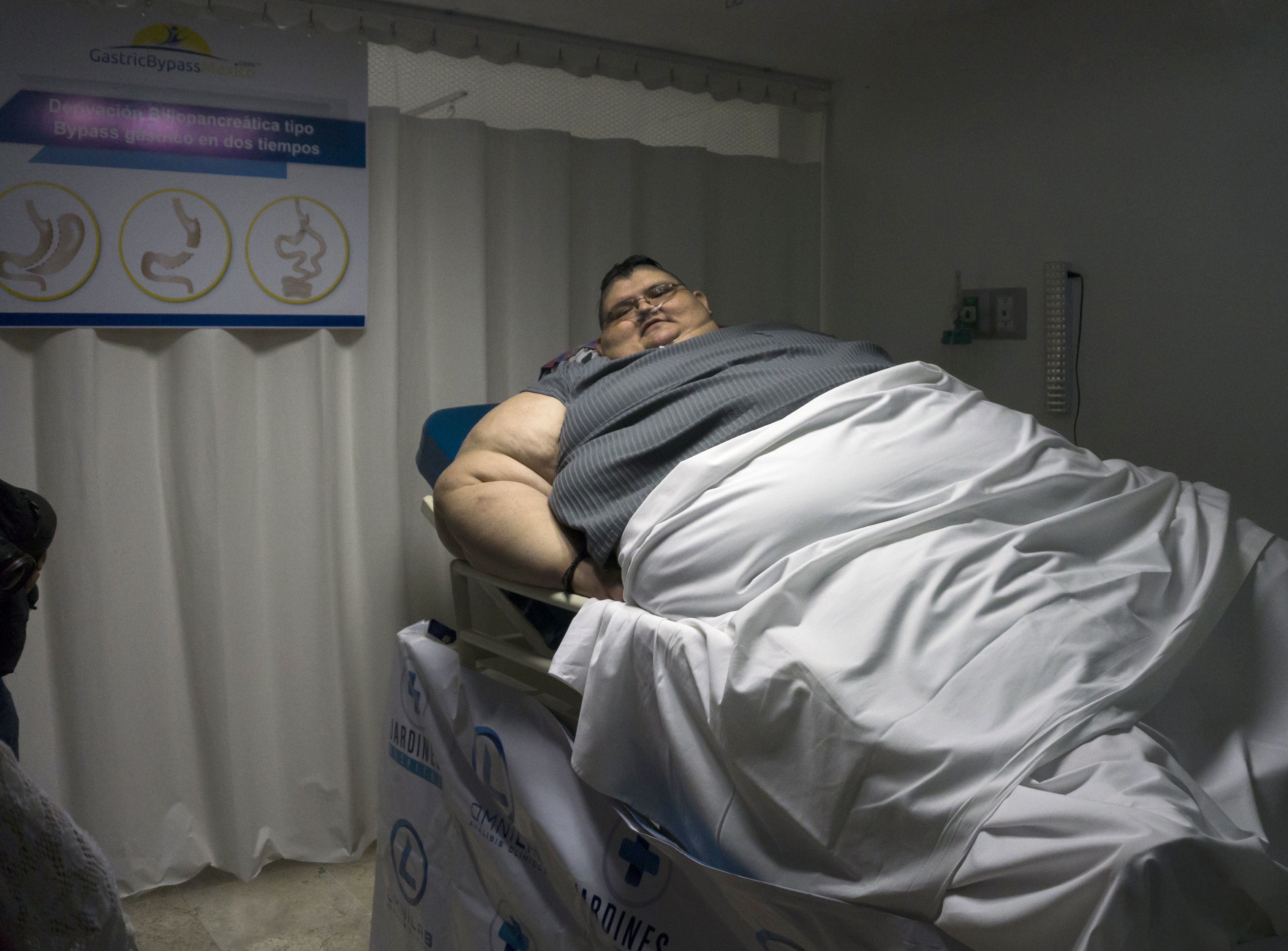 Найважчий чоловік у світі Хуан Педро Франко схуд – скільки він важить і як виглядає