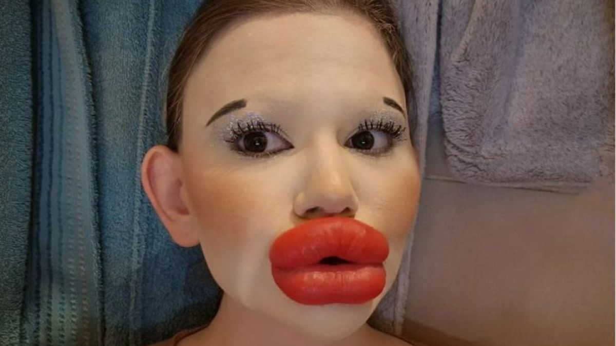 Блогерка з найбільшими губами хоче рекордно збільшити вилиці
