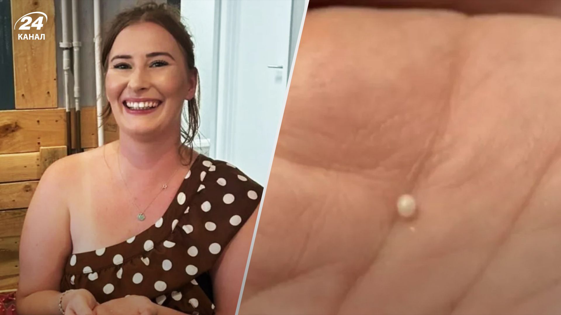 Пара из Британии нашла в своем ужине редкую жемчужину Пара из Британии нашла в своем ужине редкую жемчужину